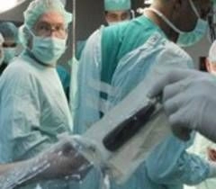 दिल्ली के अस्पताल में गले में ट्यूमर की दुर्लभ सर्जरी - Tumors throat tumors hospitals