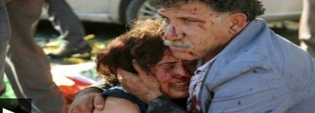 तुर्की बम विस्फोट में मृतकों की संख्या 95 हुई - Turky Blast 95 people killed