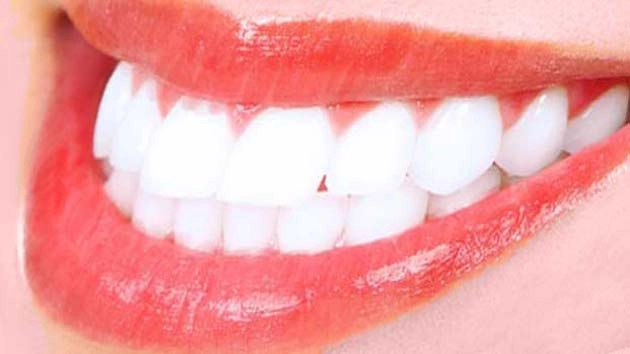 तुरंत हटेगा दांतों का पीलापन, जानिए कैसे - Whiten Teeth