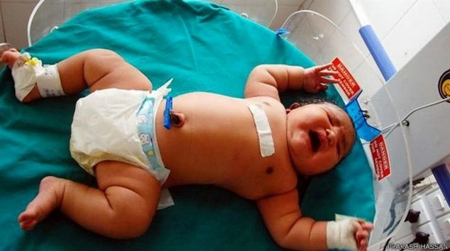 ये है भारत का 'सबसे वज़नदार बच्चा' - heaviest baby india