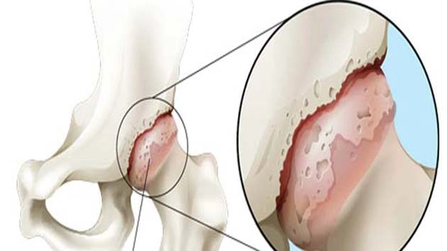 क्यों होता है जोड़ों में दर्द | joints pain reason