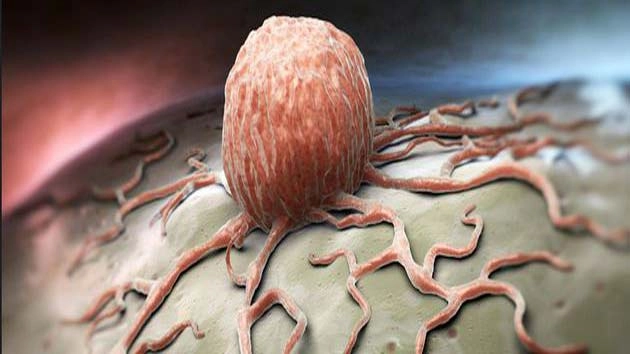 कैंसर : जानलेवा बीमारी, कारण और निदान - Cancer