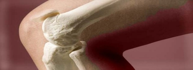 प्रयोगशाला में पहली बार विकसित की असली हड्डी.. - International news, human bone, living bone, scientific research