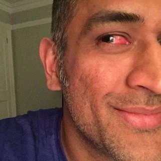 धोनी की आंख  में  चोट लगी, फोटो शेयर की - Mahendra Singh Dhoni, Eyes injury