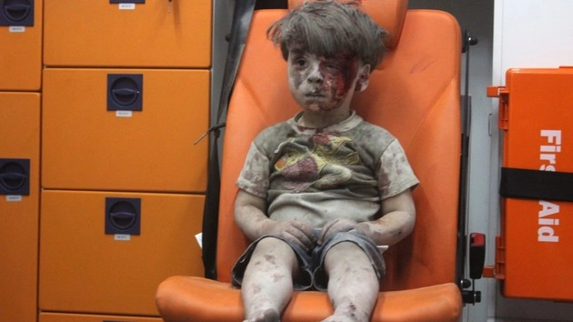 घबराया हुआ बच्चा बना सीरियाई संघर्ष का प्रतीक