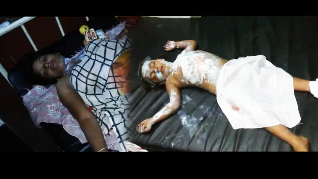 कुकर फटने से मां-बेटी घायल (वीडियो) - Cooker, wounded, mother daughter, injured