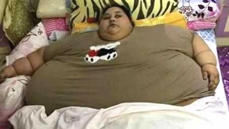 मोटापा! 25 साल से घर से बाहर नहीं निकली महिला... - Fat girl Iman Ahmad Abdulati