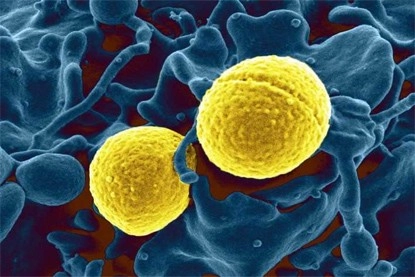 भारत में मिला सुपरबग, किसी एंटीबायोटिक का असर नहीं - Superbugs Found in India