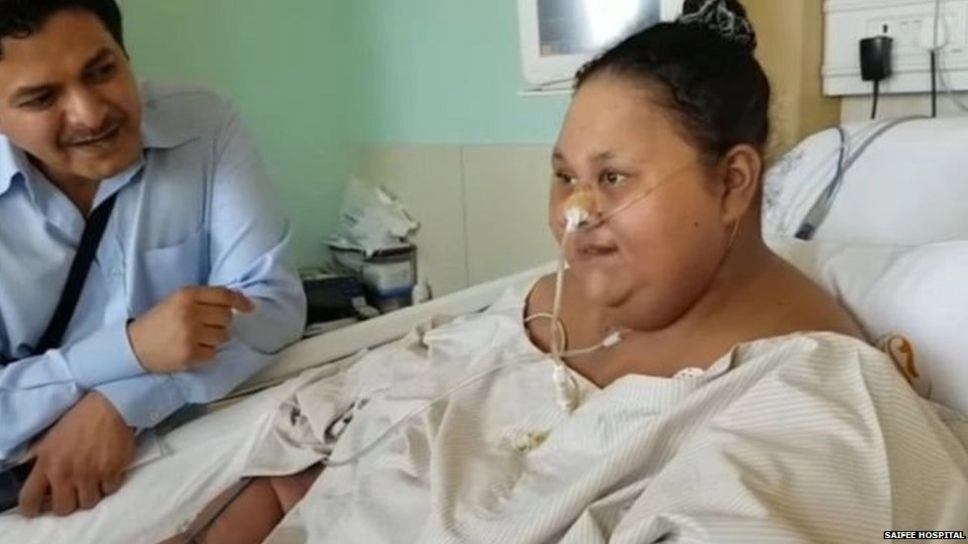 भारत में सर्जरी के बाद आधी हुई 500 किलो की महिला - Fat Women