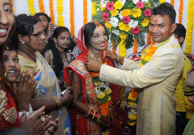 एसिड हमले की पीड़िता को मिला नया जीवन (फोटो) | Acid attack survivor Lalita Wedding photos