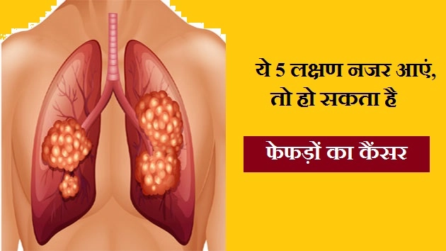 ये 5 लक्षण नजर आएं, तो हो सकता है फेफड़ों का कैंसर - Lung Cancer Symptoms In Hindi
