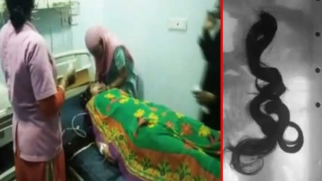 चोटी चोर : महिला बेहोश हुई और कट गई चोटी... (वीडियो)