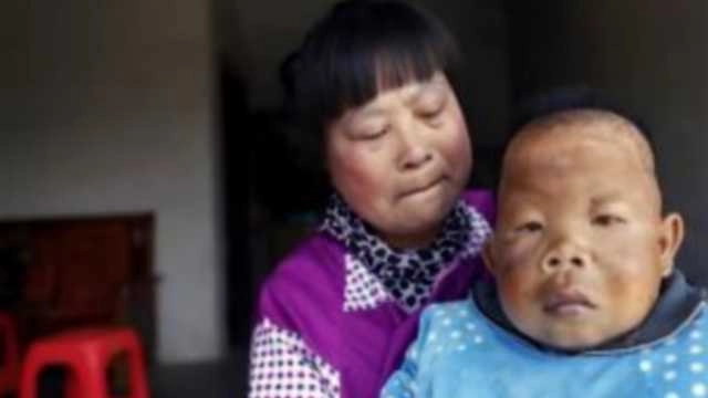 दो साल के बच्चे जैसा दिखता है वांग - Vang tiyanfang