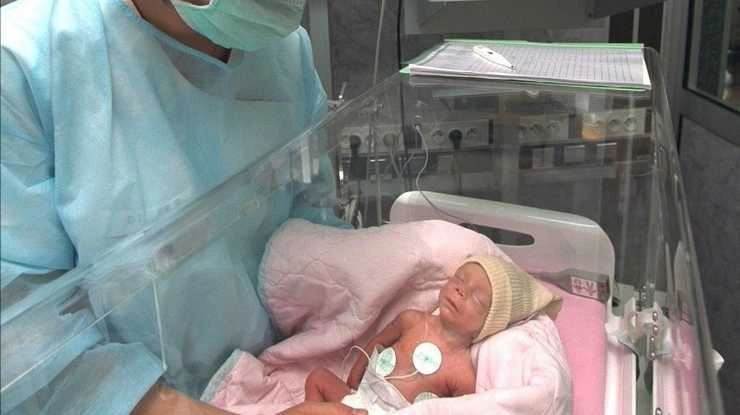 डॉक्टर ने 400 ग्राम की नवजात को बचाया - indian doctor saved most underweight baby girl