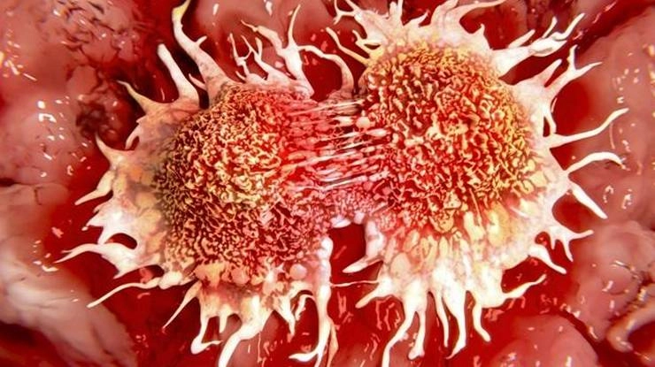 कैंसर के 10 लक्षण | Cancer