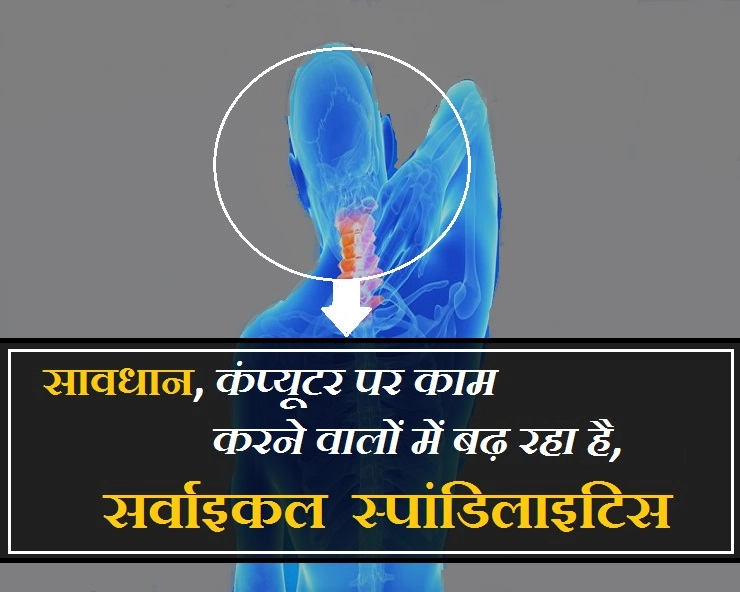 तेजी से बढ़ रही है सर्वाइकल स्पांडिलाइटिस की समस्या, कहीं इसके अगले शिकार आप तो नहीं ? - Cervical Spondylosis In Hindi