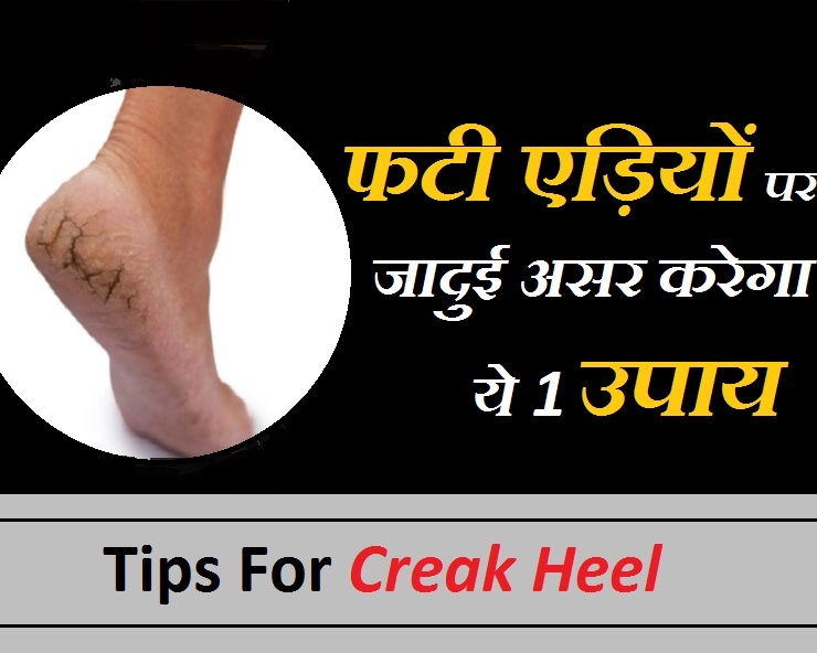 फटी एड़ियों को कहें बाय-बाय, जानिए सिर्फ 1 रामबाण उपाय... - Amazing Tips For Repair Creak Heel