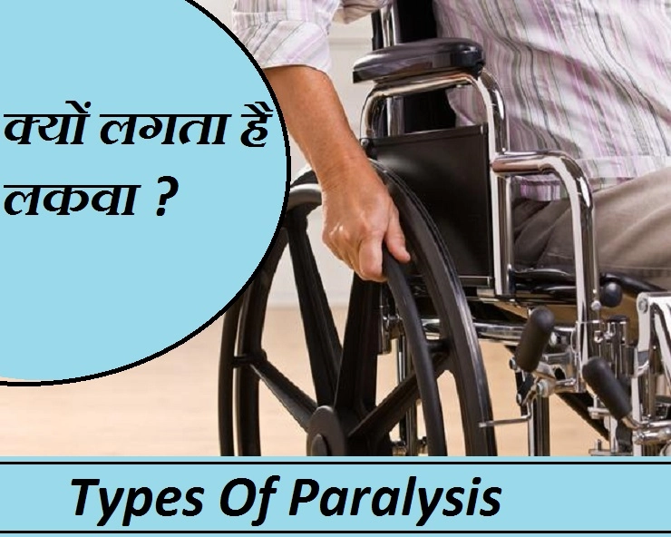 क्यों होता है पैरालिसिस? जा‍निए कारण और इसके 5 प्रकार, जो आप नहीं जानते - Types Of Paralysis