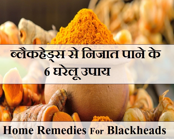 घर में रखी ये चीजें, ब्लैकहेड्स से पीछा छुड़ाने में बड़े काम की हैं... - 6 Home Remedies To Get Rid Of Blackheads