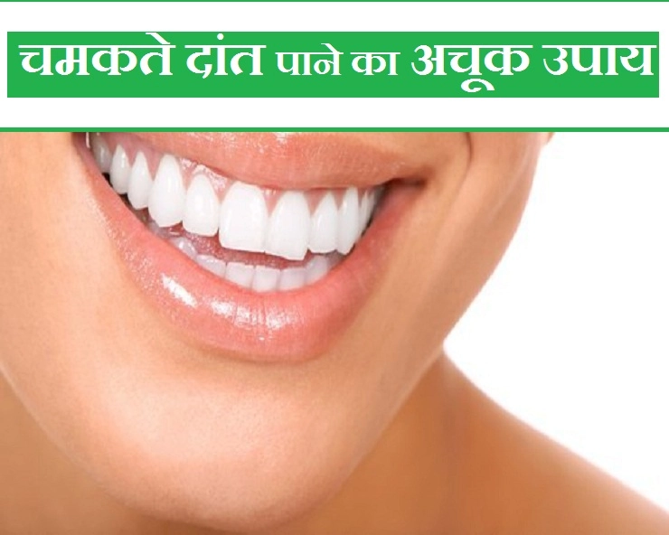 क्या दांतों का पीलापन आपके चेहरे की खूबसूरती चुरा रहा है? तो पढ़ें उपाय - home remedy for yellow teeth