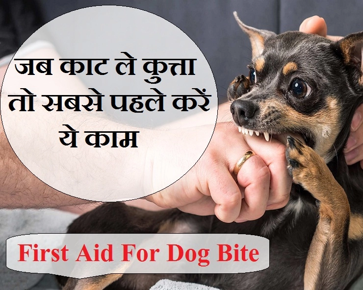 अगर किसी को काट ले कुत्ता, तो सबसे पहले उसे ये फर्स्ट ऐड दें - first aid for dog bite
