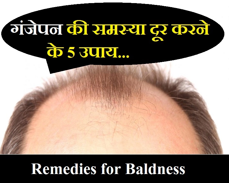 बिना किसी साइड इफेक्ट के गंजेपन से छुटकारा पाने के 5 उपाय - 5 Effective Remedies for Baldness