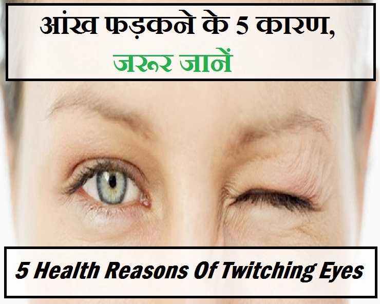 आंख फड़कने को शुभ या अशुभ का संकेत मानते हैं? तो जरा संभल जाएं, कुछ और भी कारण हो सकता है - 5 health reasons of twitching eyes