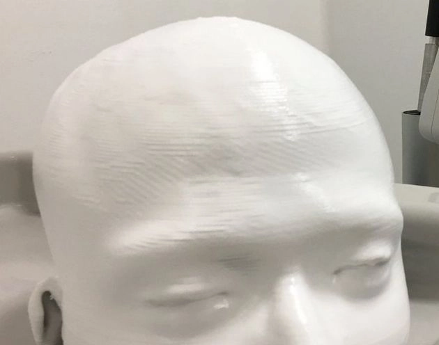 थ्रीडी प्रिंटेड खोपड़ी सी शेल खोलेगी दिमाग के राज - Unique 3D printed scalp