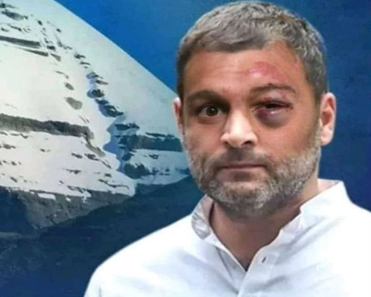 क्या राहुल गांधी को अमेठी में पीटा गया...जानिए वायरल तस्वीर का पूरा सच... - No Rahul Gandhi was not beaten up in Amethi