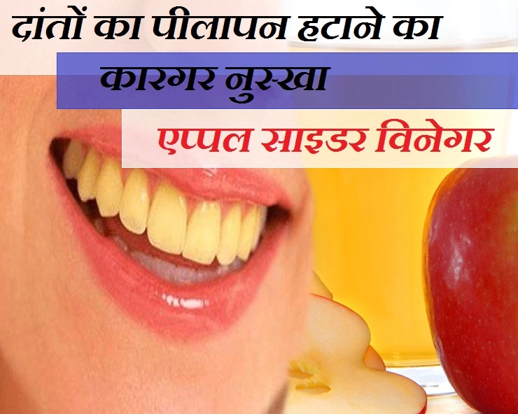 दांतों का पीलापन हटाने का कारगर नुस्खा, सेब का सिरका - apple cider vinegar for yellow teeth