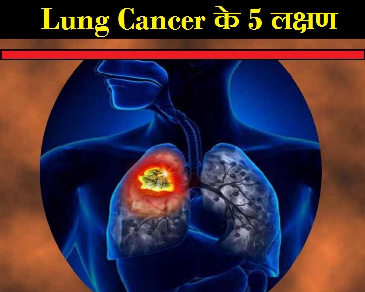 क्या आप जानते हैं फेफड़ों में कैंसर के ये 5 लक्षण? - 5 Symptoms of lung cancer