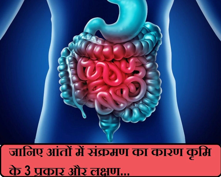 जानिए आंतों में संक्रमण का कारण कृमि के 3 प्रकार और लक्षण... - intestine infection symptoms in hindi