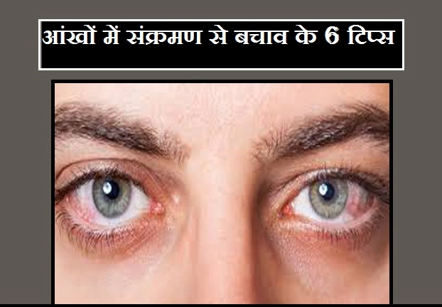 मानसून में ज्यादा है आंखों में संक्रमण की आशंका, ऐसे रहें सावधान - 6 tips to prevent eye infection