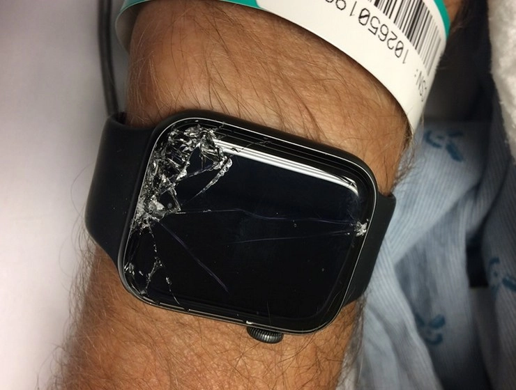 Apple Smart watch ने बचाई एक और जिंदगी, सोशल मीडिया बताई घटना की कहानी - Apple watch saves bikers life after detecting fall viral post details how