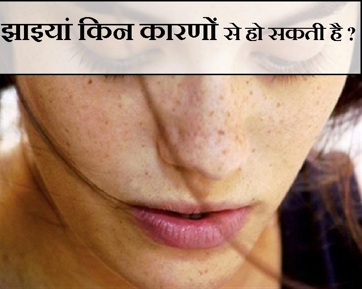 Skin Care Tips : जानिए क्या होती है चेहरे की झाइयां, इसके कारण और प्रकार - skin problem