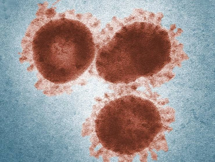 अमेरिका पहुंचा चीन का कोरोना वायरस, सामने आए 440 मामले