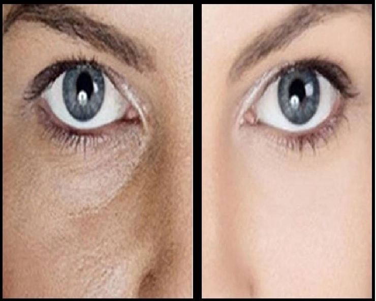Beauty Tips : चेहरे के खुले पोर्स को बंद करने के लिए अपनाएं यह उपाय - Tips For Open Pores