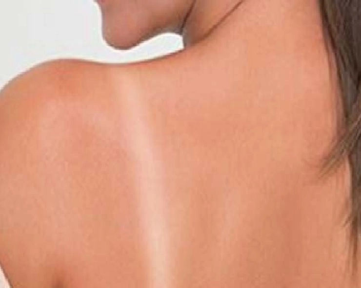skin care : जानिए Tanning हटाने के लिए  खास Tips - Effective Tips For Tanning