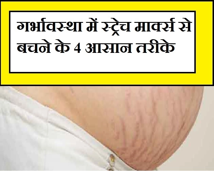 Pregnancy: stretch marks से हैं परेशान ? अपनाएं  खास टिप्स - avoiding stretch marks