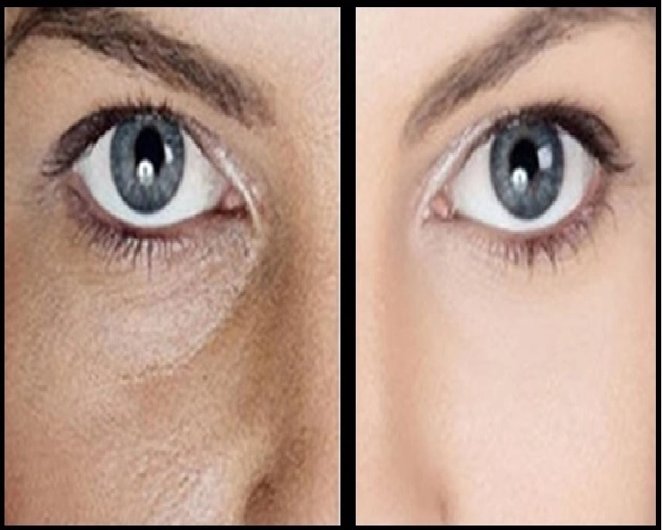 Skin Care : त्वचा के खुले Pores को बंद करने के लिए अपनाएं यह Tips - Tips For Open Pores