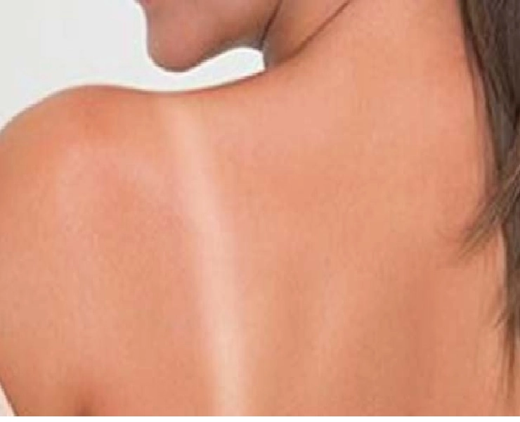 Tips For Tanning : त्वचा से टैनिंग हटाने के लिए खास उपाय - Effective Tips For Tanning