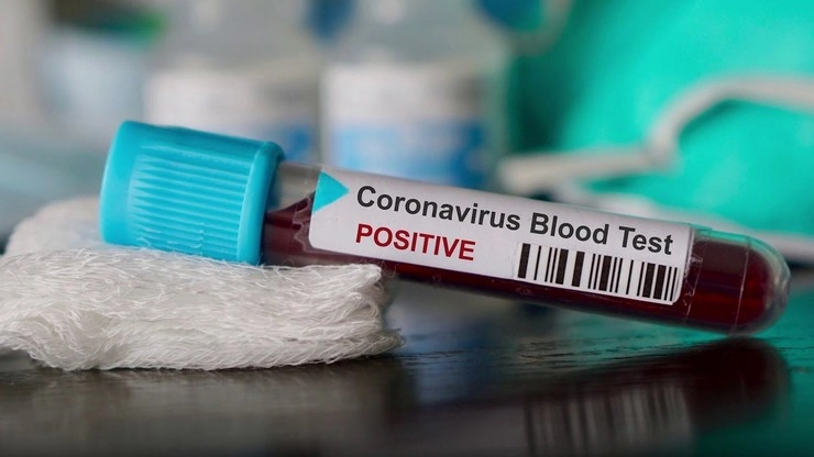 Coronavirus: દેશમાં મૃત્યુનો આંક 40 હજારને વટાવી ગયો, છેલ્લા 24 કલાકમાં રેકોર્ડ 56283 કેસ નોંધાયા