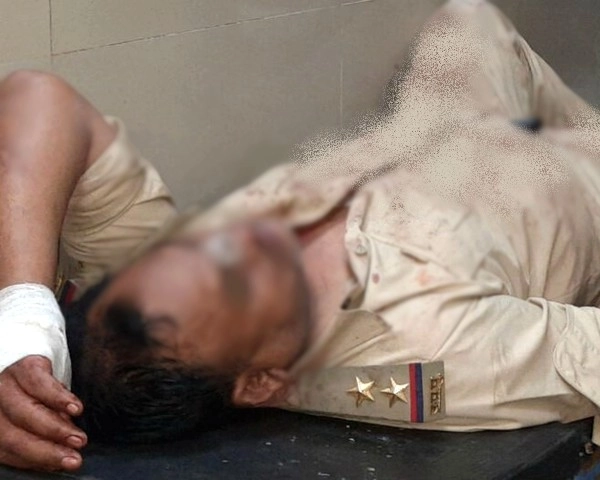 यूपी में एक और बिकरू कांड, चोर पकड़ने गई पुलिस पर हमला, एसआई गंभीर
