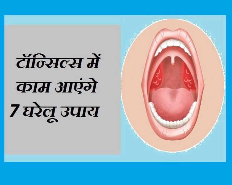 टॉन्‍सि‍ल्स या गले में इंफेक्शन हो जाए, तो अपनाएं 7 घरेलू उपाय - Home Remedy For Tonsillitis in hindi
