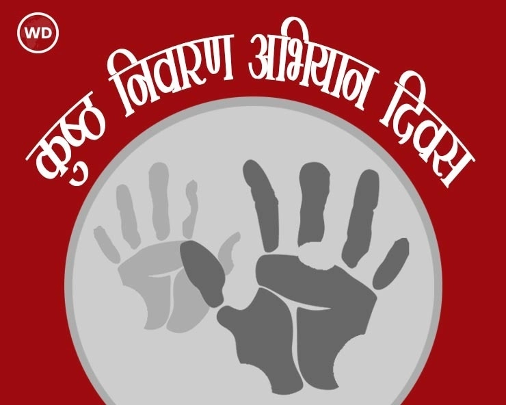 23 जनवरी : कुष्‍ठ निवारण अभियान दिवस आज, जानिए लक्षण एवं उपचार - Leprosy Prevention Campaign Day 2021