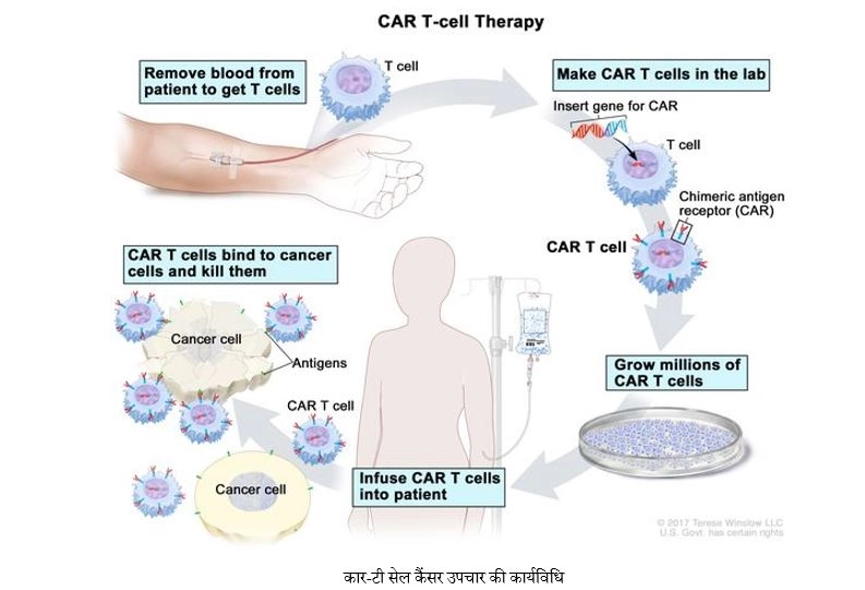 कैंसर के ‘आखि‍री स्‍टेज’ के मरीजों की बच सकेगी ‘कार-टी थैरेपी’ से जान - CAR-T Cell, Cancer Therapy, BIRAC