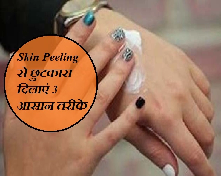 Monsoon Skin Care Tips : नहीं निकलेगी हाथ-पैरों की त्‍वचा, आजमाएं 3 आसान तरीके