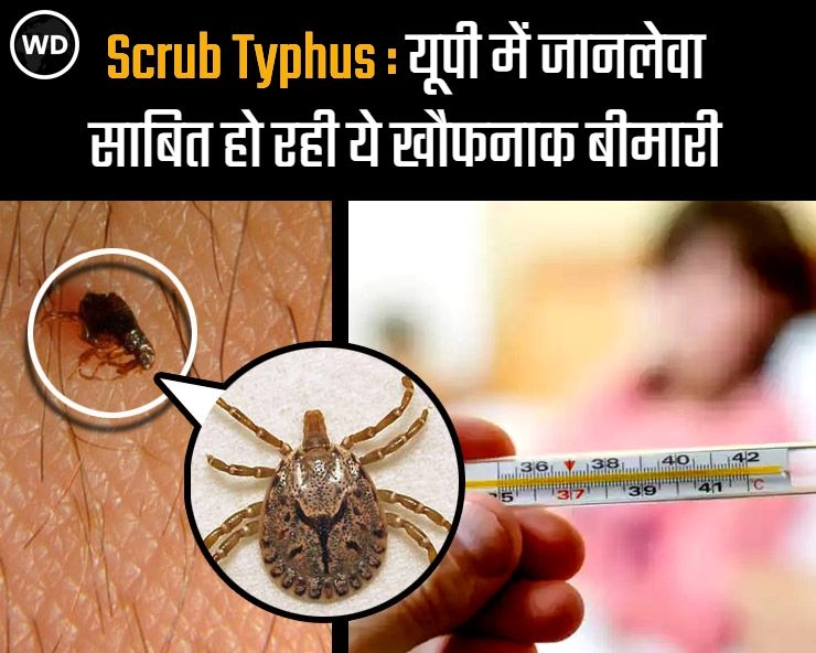 Scrub Typhus : यूपी के बाद मप्र  में भी कोरोना के साथ-साथ नया खतरा