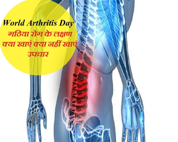 World Arthritis Day - जानिए क्‍या होता है गठिया रोग, अंगुलियों के दर्द से होती है शुरुआत
