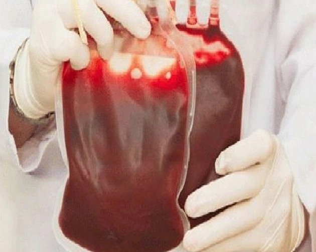 इंसानी खून में मिला प्लास्टिक, हैरान रह गए वैज्ञानिक
